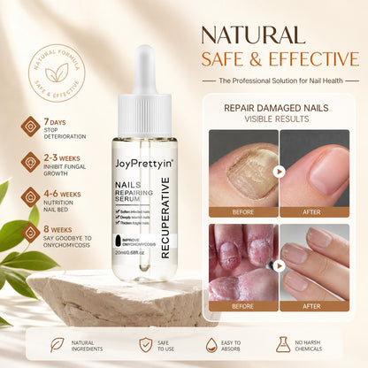 JoyPrettyin Nail Care Pro – Nail Renewal Serum for Damaged & Discolored Nails