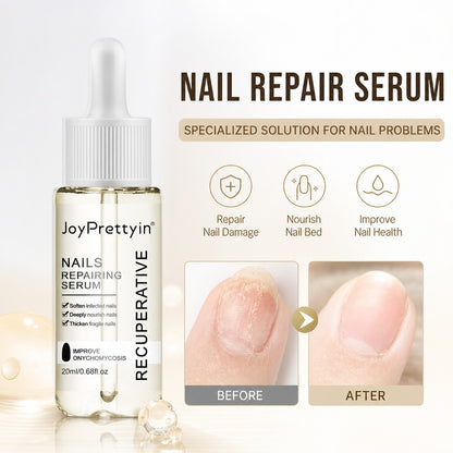 JoyPrettyin Nail Care Pro – Nail Renewal Serum for Damaged & Discolored Nails