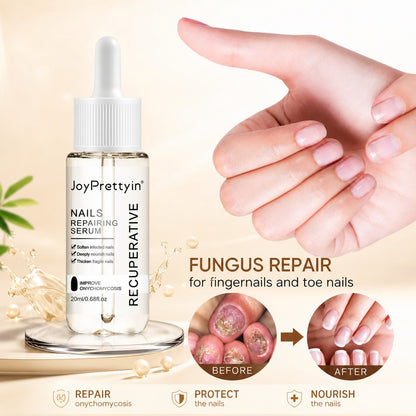 JoyPrettyin Nail Care Pro – Nail Renewal Serum for Damaged & Discolored Nails
